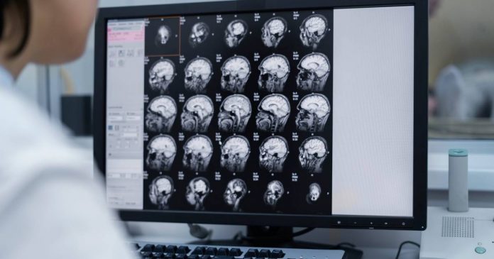 Cérebros de pessoas com ansiedade ou depressão têm variação na resposta ao medo